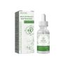 EELHOE Ear Relief Relieves Blocked Inner Ear Ringing Ear Discomfort Ear Health Care Ear Drops